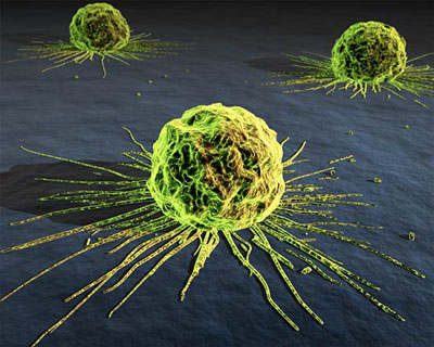 Una empresa catalana inventa un virus contra el càncer