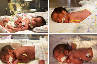 Una dona dóna a llum a dos parells de bessons idèntics a un hospital de Houston