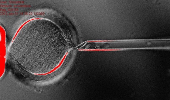 Clonació de cèllules mare embrionàries de persones