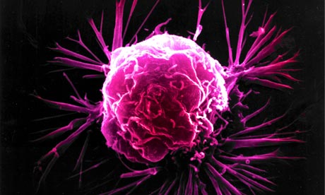 Gran pas en la recerca contra el càncer de mama